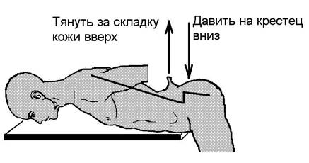 Позвоночник в зоне L.5 - S.1