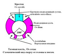 Круглая конфигурация тазовых костей (при виде сверху) у младенца с «врожденным» вывихом бедра
