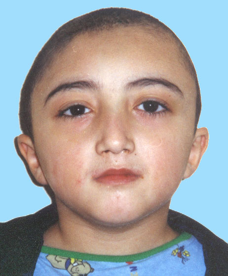 plagio frontal face po.JPG (50540 bytes)